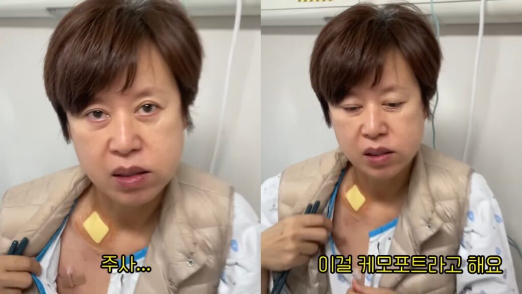 박미선